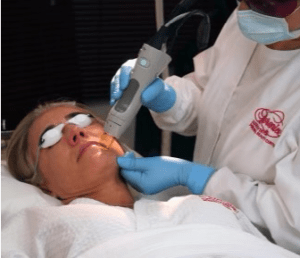 Berenice Electrolysis