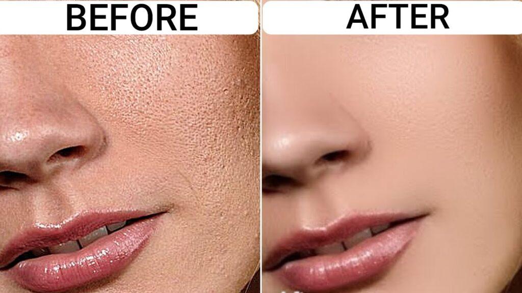 How to get rid of textured skin with exfoliation