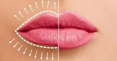 How Hyaluronic Acid Can Reshape Your Lips