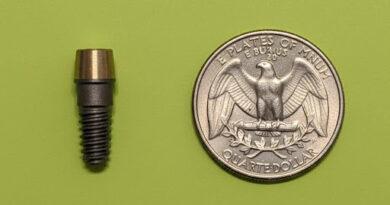 The Dental Implant : I Accidentally Pulled Out of My Jaw – Why?