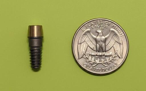 The Dental Implant : I Accidentally Pulled Out of My Jaw – Why?
