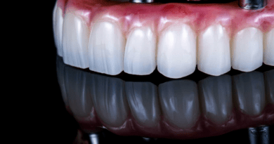The Smile Investment: Why Full-Arch Implants Are the Quiet Luxury of Self-Care