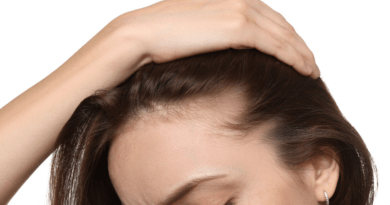What a Hair Clinic Toronto Team Offers Beyond Hair Transplant Surgery