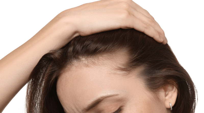 What a Hair Clinic Toronto Team Offers Beyond Hair Transplant Surgery
