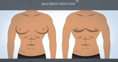 The Health Benefits of Breast Reduction That Deserve More Attention
