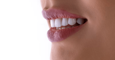 Celebrity's Perfect Smile