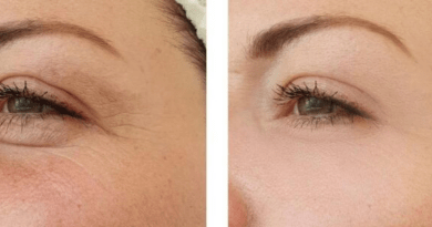 The Benefits and Applications of Rejuran Treatment
