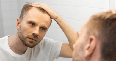 PRP, Exosomes and Low Level Laser: Which Non-Surgical Hair Treatments Are Worth Considering
