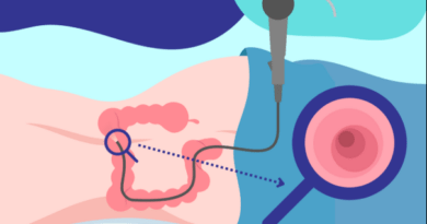 Colonoscopy