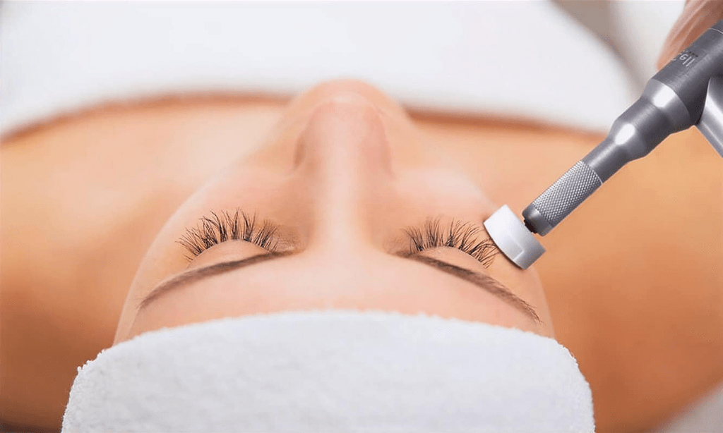 Microchanneling Guide: Everything You Need to Know About This Professional Skin Rejuvenation Treatment