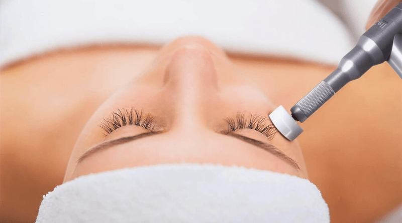 Microchanneling Guide: Everything You Need to Know About This Professional Skin Rejuvenation Treatment
