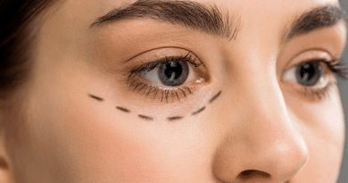 How to Prepare for Facial Plastic Surgery for a Smoother Recovery