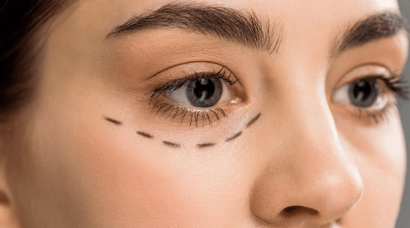 How to Prepare for Facial Plastic Surgery for a Smoother Recovery