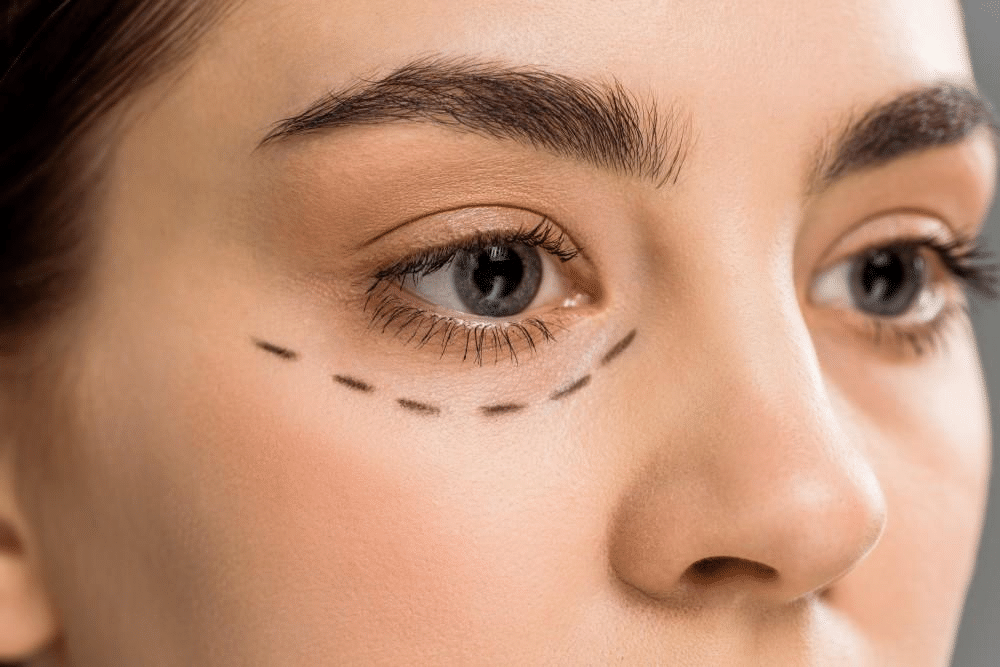 How to Prepare for Facial Plastic Surgery for a Smoother Recovery