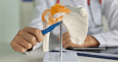Things to Know Before Choosing an Orthopedic Surgeon for Shoulder Replacement Surgery