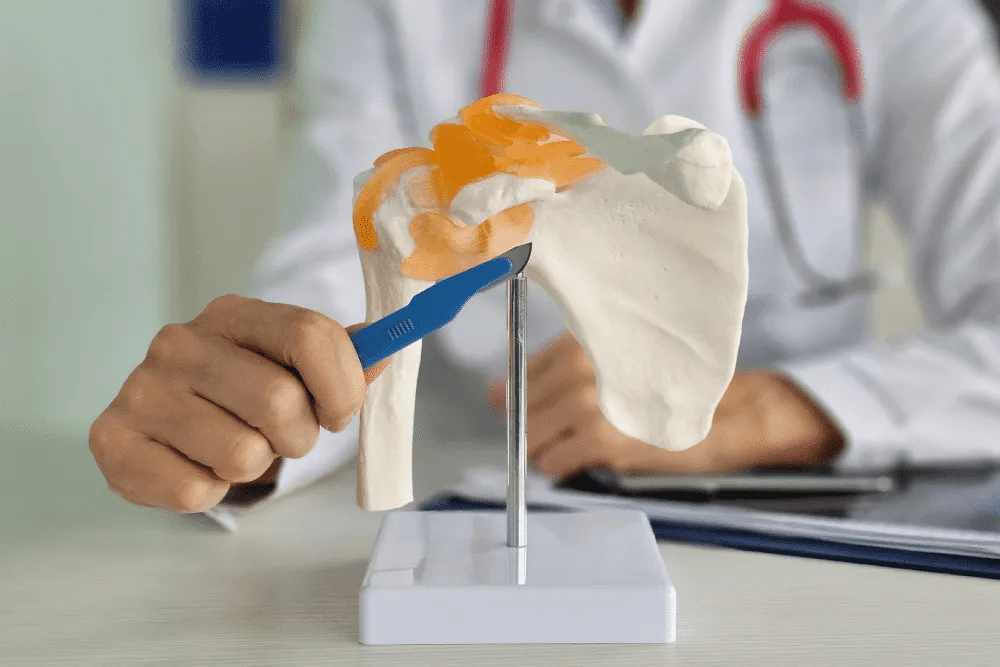 Things to Know Before Choosing an Orthopedic Surgeon for Shoulder Replacement Surgery